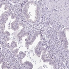 Immunohistochemical staining of human endometrium shows no positivity in glandular cells as expected.