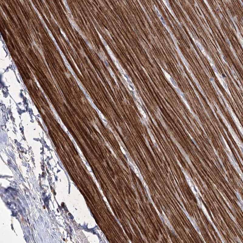 Anti-WASHC3 Antibody