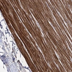 Anti-WASHC3 Antibody