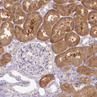 Immunohistochemical staining of human kidney shows strong cytoplasmic positivity in cells in tubules.