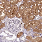 Immunohistochemical staining of human kidney shows strong cytoplasmic positivity in cells in tubules.