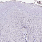 Immunohistochemical staining of human squamous epithelia shows no positivity in squamous epithelial cells as expected.