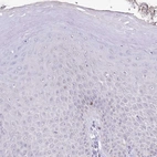 Immunohistochemical staining of human squamous epithelia shows no positivity in squamous epithelial cells as expected.