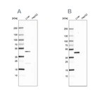 Western blot analysis using Anti-HPD antibody HPA038322 (A) shows similar pattern to independent antibody HPA038321 (B).