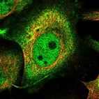 Immunofluorescent staining of human cell line U-2 OS shows localization to nucleoplasm & cytosol.