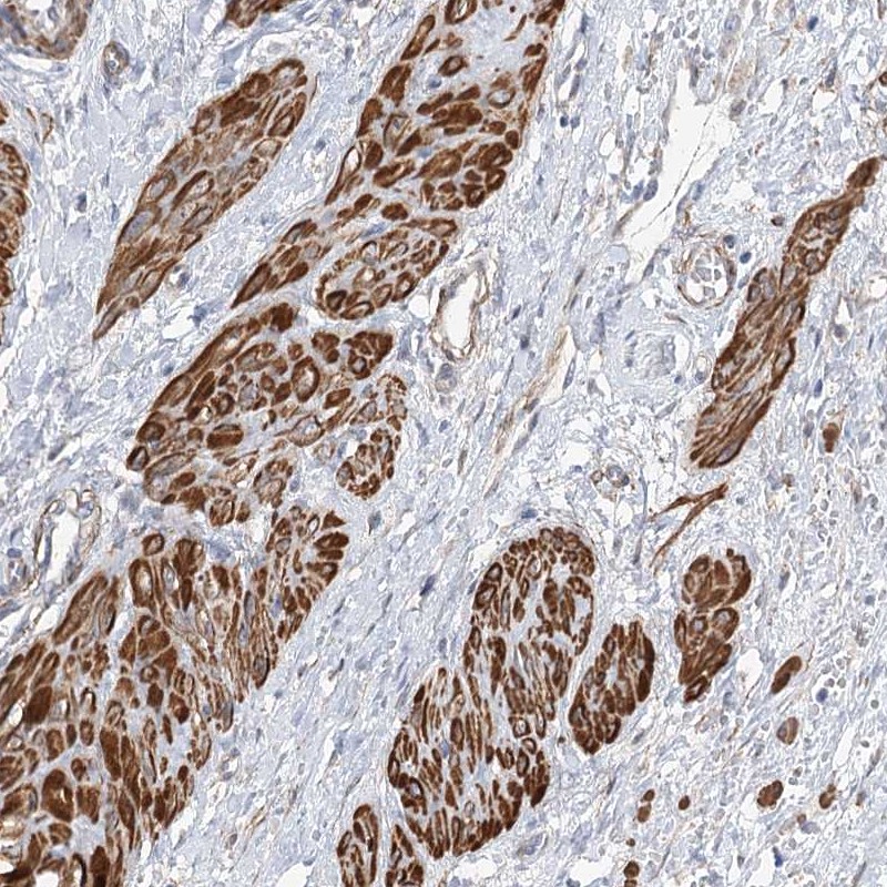 Anti-WASHC3 Antibody