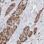 Anti-WASHC3 Antibody