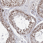 Immunohistochemical staining of human testis shows strong nuclear positivity in cells in seminiferous ducts.