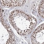 Immunohistochemical staining of human testis shows strong nuclear positivity in cells in seminiferous ducts.