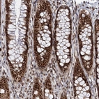 Immunohistochemical staining of human rectum shows strong nuclear positivity in glandular cells.