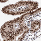 Immunohistochemical staining of human fallopian tube shows strong nuclear positivity in glandular cells.