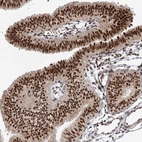 Immunohistochemical staining of human fallopian tube shows strong nuclear positivity in glandular cells.