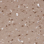 Immunohistochemical staining of human cerebral cortex shows strong nuclear positivity in neurons.
