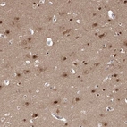 Immunohistochemical staining of human cerebral cortex shows strong nuclear positivity in neurons.