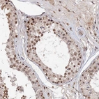 Immunohistochemical staining of human testis shows strong nuclear positivity in cells in seminiferous ducts.