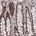 Immunohistochemical staining of human rectum shows strong nuclear positivity in glandular cells.