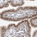 Immunohistochemical staining of human fallopian tube shows strong nuclear positivity in glandular cells.