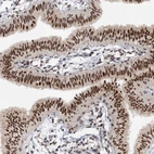 Immunohistochemical staining of human fallopian tube shows strong nuclear positivity in glandular cells.