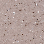 Immunohistochemical staining of human cerebral cortex shows strong nuclear positivity in neurons.