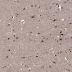 Immunohistochemical staining of human cerebral cortex shows strong nuclear positivity in neurons.