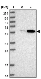 Lane 1: Marker [kDa] 250, 130, 95, 72, 55, 36, 28, 17, 10_br/_Lane 2: Human cell line RT-4_br/_Lane 3: Human cell line U-251MG sp