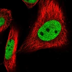 Immunofluorescent staining of human cell line U-251 MG shows localization to nucleoplasm.