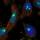 Immunofluorescent staining of human cell line U-251 MG shows localization to nucleoli.