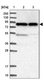 Lane 1: Marker [kDa] 250, 130, 95, 72, 55, 36, 28, 17, 10_br/_Lane 2: Human cell line RT-4_br/_Lane 3: Human cell line U-251MG sp