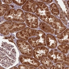 Anti-PCBP2 Antibody
