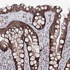 Immunohistochemical staining of human rectum shows strong membranous /cytoplasmic positivity in glandular cells.