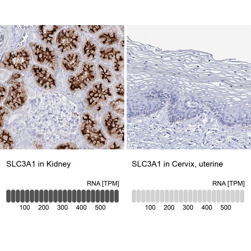 Anti-SLC3A1 Antibody