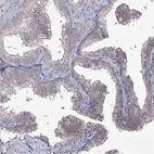 Immunohistochemical staining of human prostate shows weak membranous positivity in glandular cells.