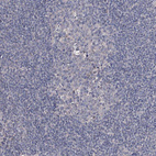 Immunohistochemical staining of human lymph node shows low positivity in germinal center cells as expected.