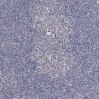 Immunohistochemical staining of human lymph node shows low positivity in germinal center cells as expected.