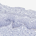 Immunohistochemical staining of human cervix shows no positivity in squamous epithelial cells as expected.