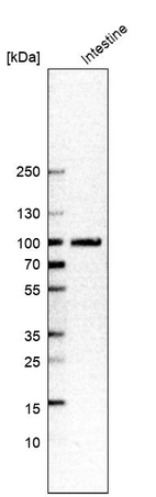 Western blot analysis in human small intestine tissue.
