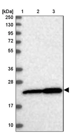 Lane 1: Marker [kDa] 250, 130, 95, 72, 55, 36, 28, 17, 10_br/_Lane 2: Human cell line RT-4_br/_Lane 3: Human cell line U-251MG sp