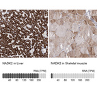 Anti-NADK2 Antibody