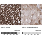 Anti-NADK2 Antibody