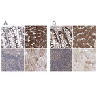Immunohistochemical staining of human colon, liver, lymph node and skeletal muscle using Anti-NADK2 antibody HPA038367 (A) shows similar protein distribution across tissues to independent antibody HPA038366 (B).