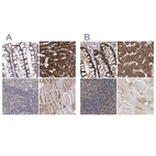 Immunohistochemical staining of human colon, liver, lymph node and skeletal muscle using Anti-NADK2 antibody HPA038367 (A) shows similar protein distribution across tissues to independent antibody HPA038366 (B).