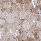 Immunohistochemical staining of human skeletal muscle shows low expression as expected.
