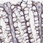 Immunohistochemical staining of human colon using Anti-NADK2 antibody HPA038367.