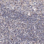 Immunohistochemical staining of human lymph node using Anti-NADK2 antibody HPA038367.