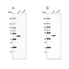 Western blot analysis using Anti-NADK2 antibody HPA038367 (A) shows similar pattern to independent antibody HPA038366 (B).