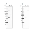 Western blot analysis using Anti-NADK2 antibody HPA038367 (A) shows similar pattern to independent antibody HPA038366 (B).