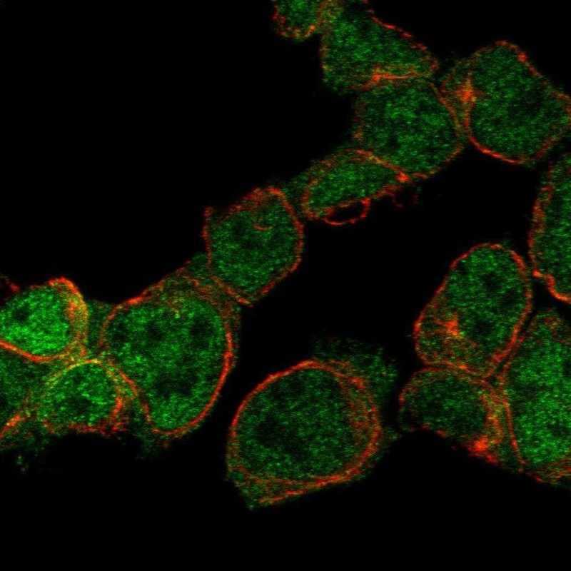 Anti-ZNF302 Antibody