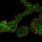 Anti-ZNF302 Antibody