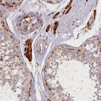 Anti-SUPV3L1 Antibody