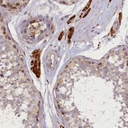 Anti-SUPV3L1 Antibody